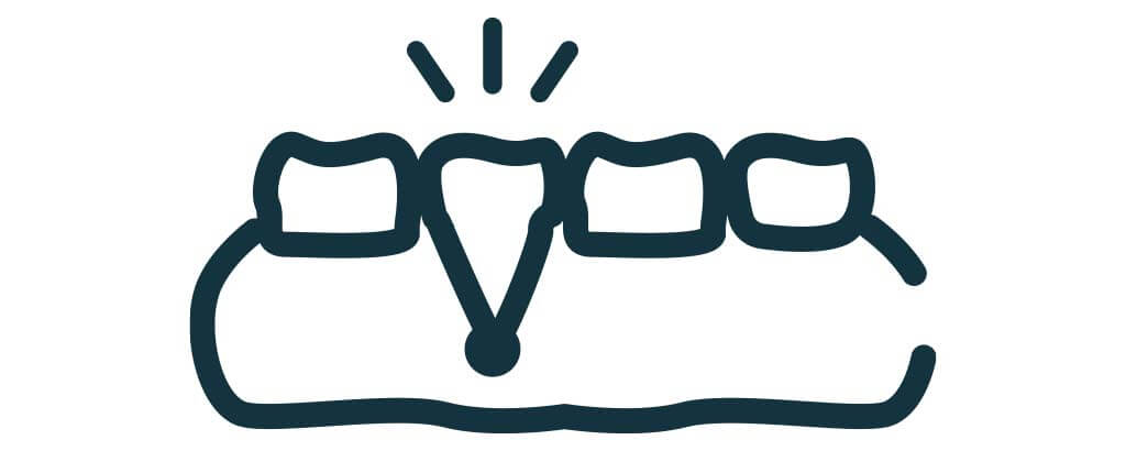 apicoectomy symbol 1024 by 410 pixels