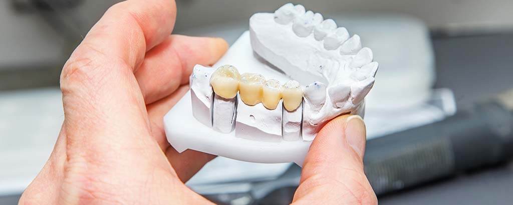 a dentist holds a model of a dental bridge