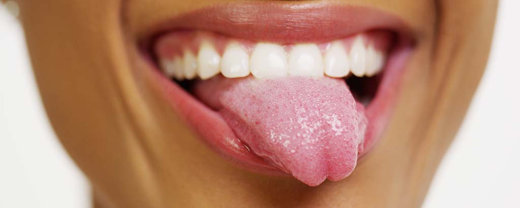a woman sticks out her tongue after getting a lingual frenectomy