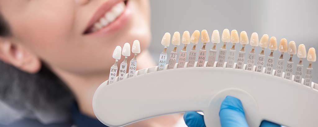 a woman talks to her dentist about veneers