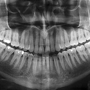 a dentist looks at dental x rays