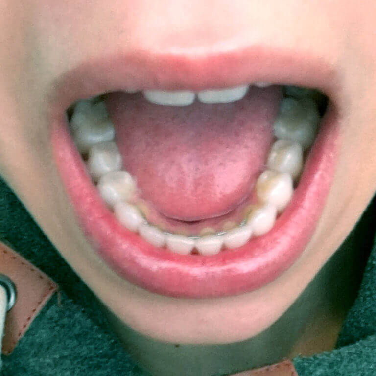 Bristol Park Dental -