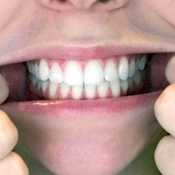 Bristol Park Dental -