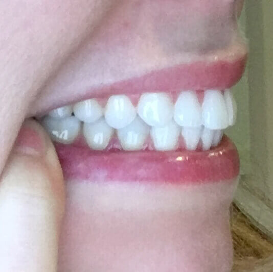 Bristol Park Dental -