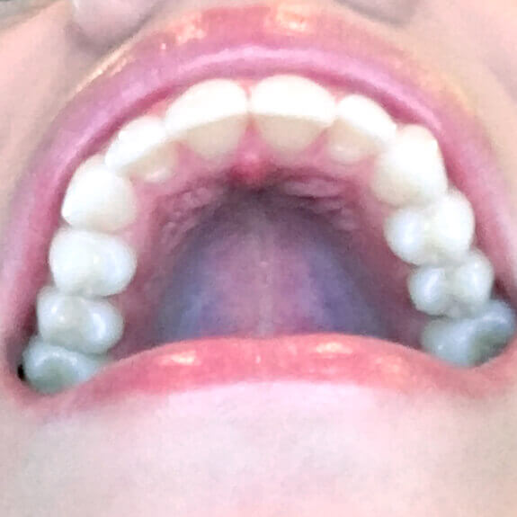 Bristol Park Dental -