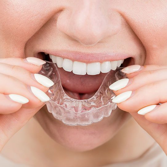 Bristol Invisalign