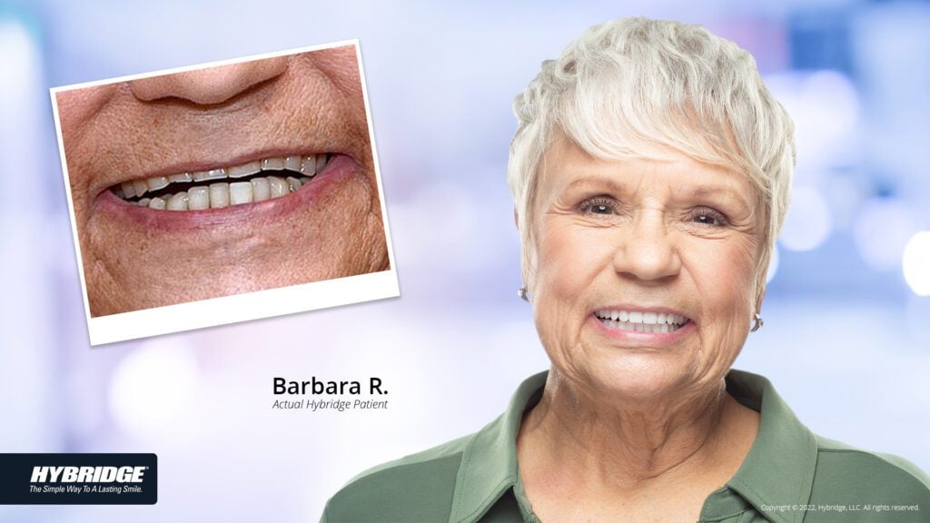 before-after_smile_gallery_w-bkgds_barb-r_1920x1080