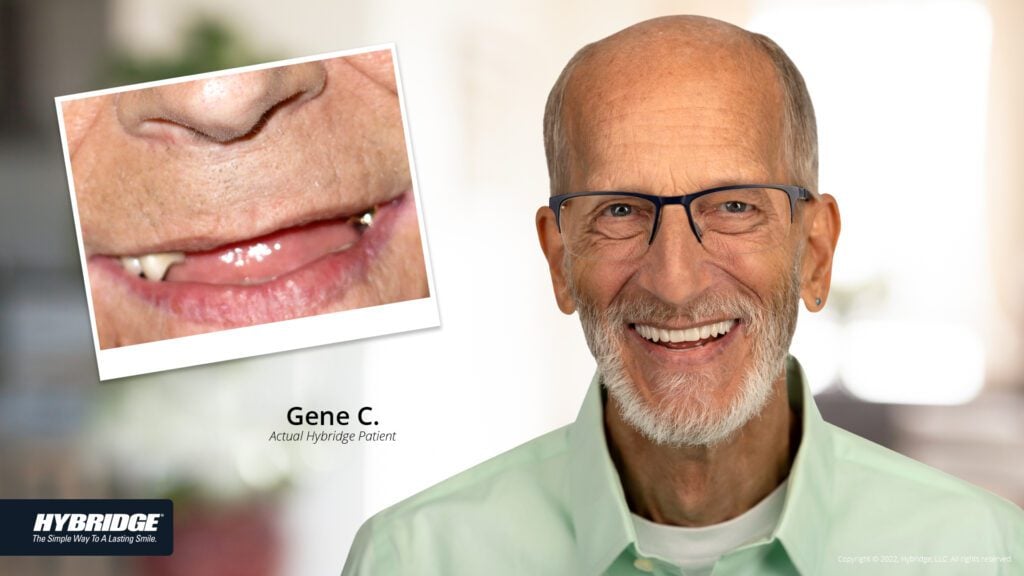 before-after_smile_gallery_w-bkgds_gene_1920x1080