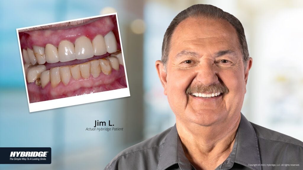 before-after_smile_gallery_w-bkgds_jim-l_1920x1080_2