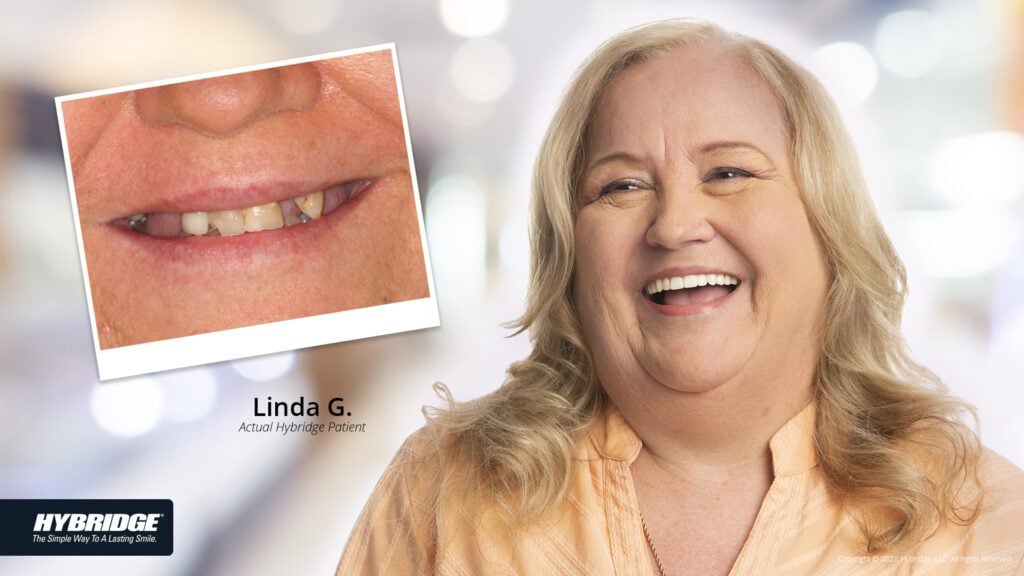 before-after_smile_gallery_w-bkgds_linda-g_1920x1080