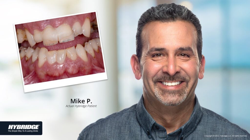 before-after_smile_gallery_w-bkgds_mike-p_1920x1080_2