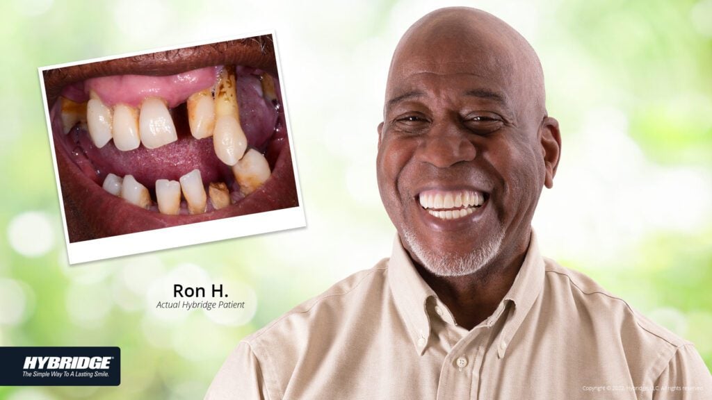 before-after_smile_gallery_w-bkgds_ron-h_1920x1080