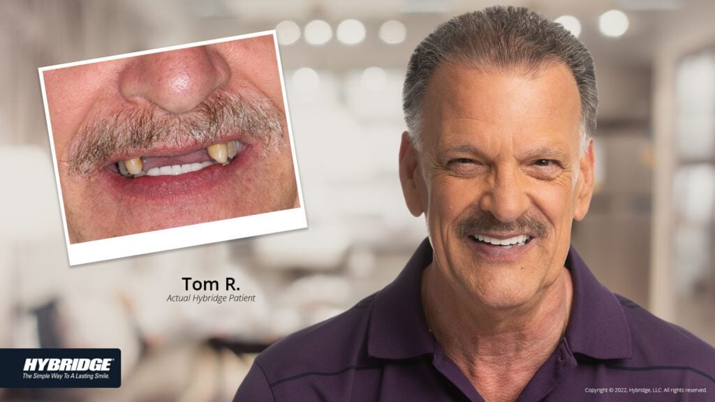 before-after_smile_gallery_w-bkgds_tom-r_1920x1080_2